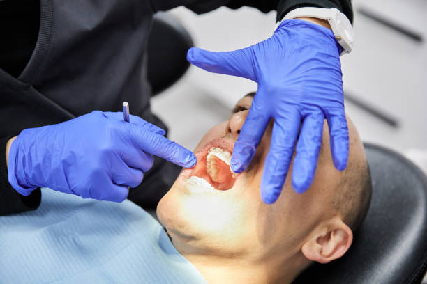 Best Emergency Wisdom Teeth Removal in Muhlenberg Rk, PA