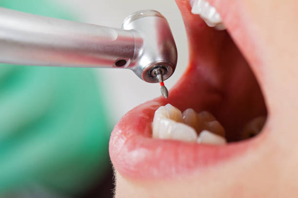 Best Emergency Root Canal Treatment in Muhlenberg Rk, PA